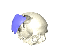 Skull Defect Reconstruction